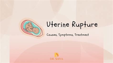 Uterine Rupture | Childbirth complications | Treatment