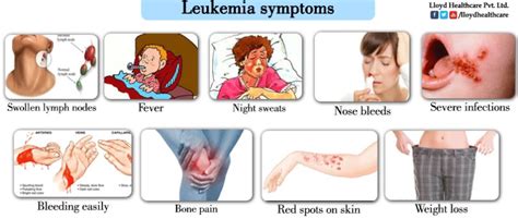 Leukemia-symptoms - Alicia Llanas