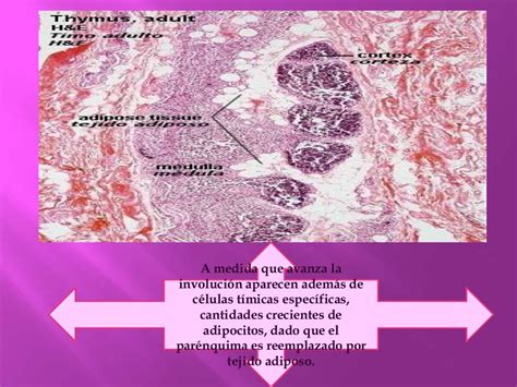 Timo. HISTOLOGÍA