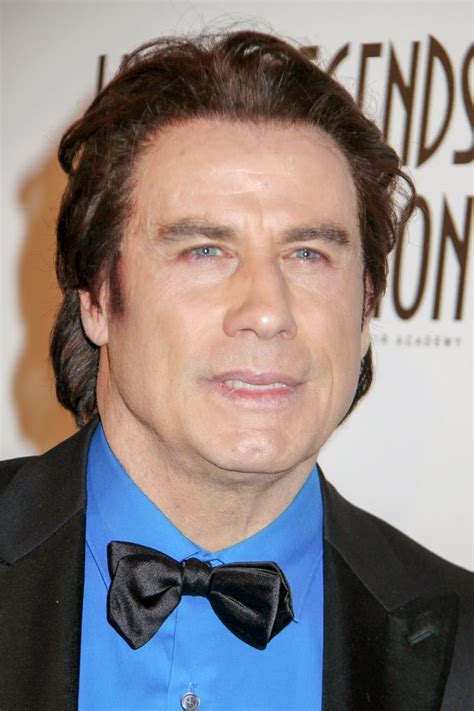 Celebrity Hair Loss: John Travolta's Toupee