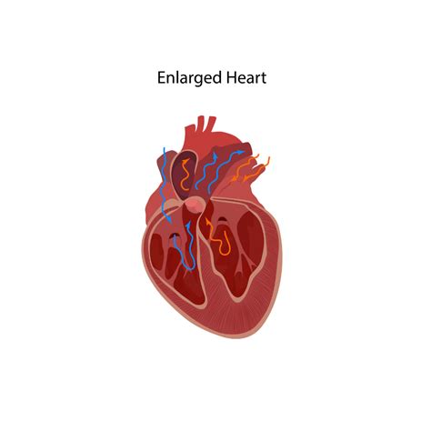 What is an Enlarged Heart? - Showit Blog