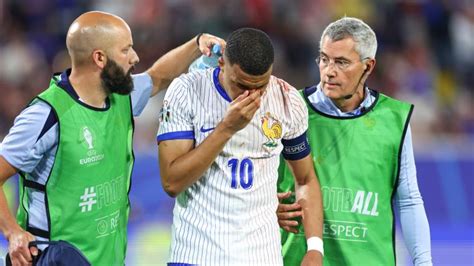 Kylian Mbappe to Don Protective Face Mask at Euro 2024 After Broken ...