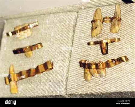 Ancient Egypt Dentistry3 Stock Photo - Alamy