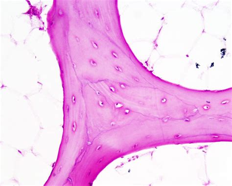 File:Bone histology 012.jpg - Embryology