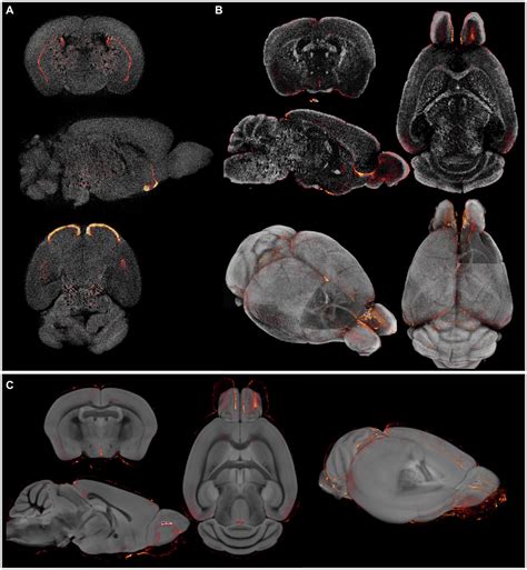 Frontiers | An MR-based brain template and atlas for optical projection ...