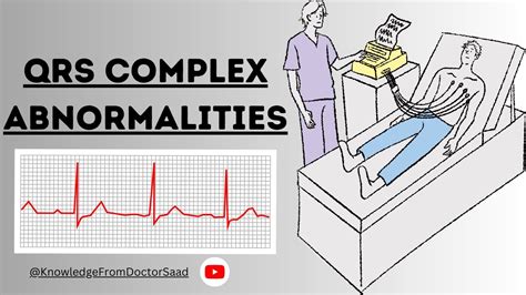 Understanding QRS Complex Abnormalities: Causes, Symptoms, and Diagnosis | ECG #cardiachealth ...