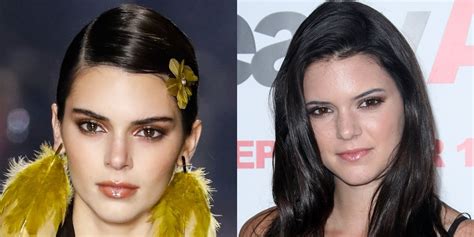 Did Kendall Jenner Undergo Plastic Surgery? Her Candid Thoughts and Iconic Runway Moments