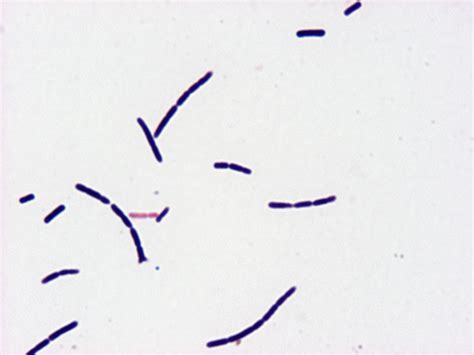 Lactobacillus Gram Stain