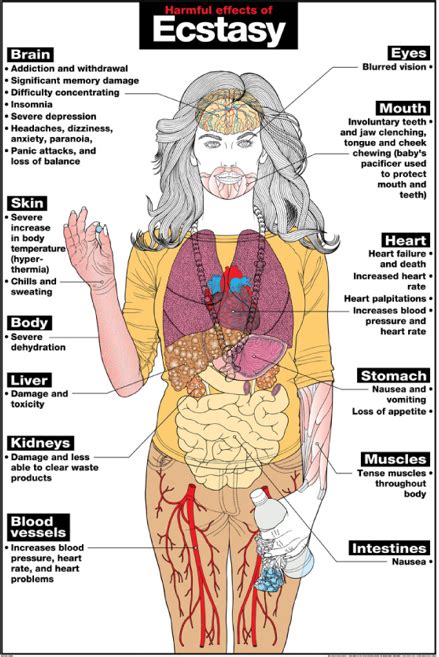 MacGill | Harmful Effects of Ecstasy Laminated Poster