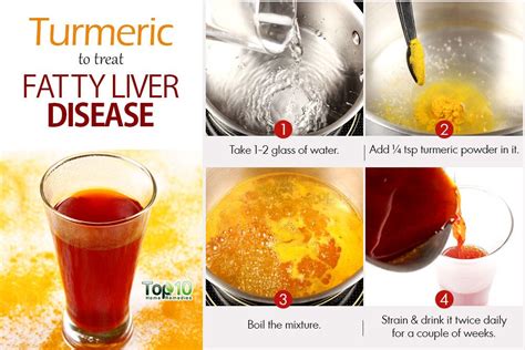 Home Remedies for Fatty Liver Disease | Top 10 Home Remedies