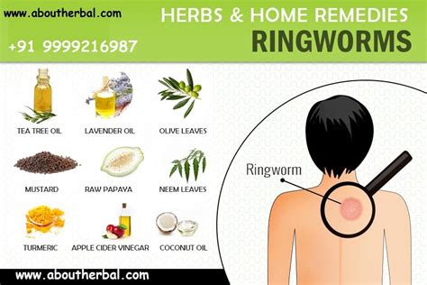 Astonishing Home Remedies for Ringworm Treatment – How to get free of ...