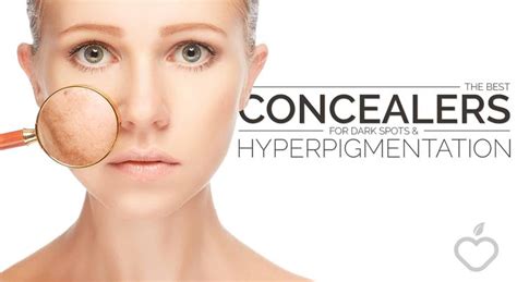 The Best Concealers for Dark Spots and Hyperpigmentation - Positive ...