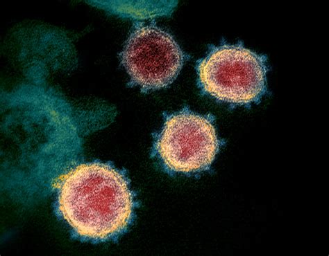 Novel Coronavirus SARS-CoV-2 | This transmission electron mi… | Flickr