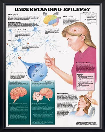 Understanding Epilepsy anatomy poster shows brain activity and defines the main forms of ...