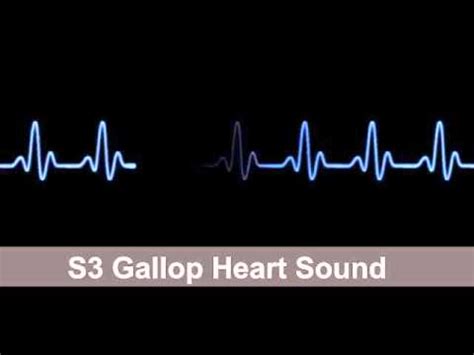 S3 Gallop Heart Sound Collection For Auscultation Skills - YouTube