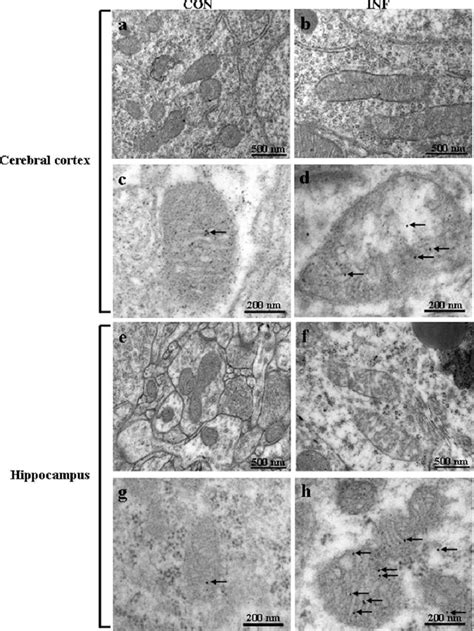 Electron microscopy of the mitochondria in brains from control and ...