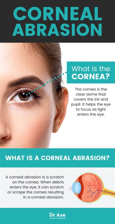 Corneal Abrasion: 6 Natural Ways to Relieve a Scratched Eye - Dr. Axe