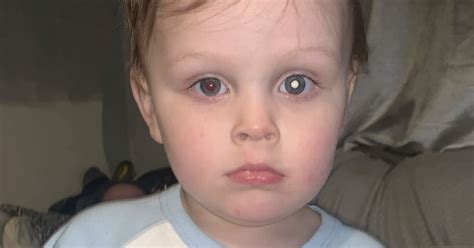 A Mother Noticed Her Son's 'Cloudy' Eye. It Turned Out To Be Eye Cancer.