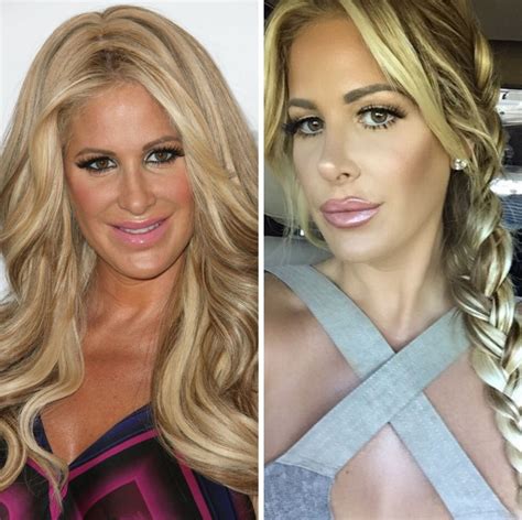 Kim Zolciak Biermann How real is she after Plastic surgery?