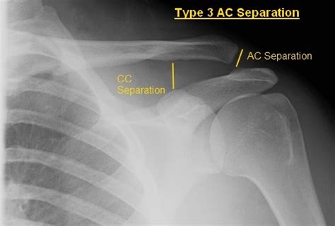 Ortho Blog - Carolinas Electronic Compendium