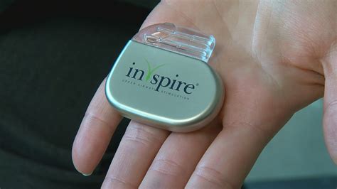 Highland Hospital offers 'Inspire' device to help sleep apnea patients | WHAM