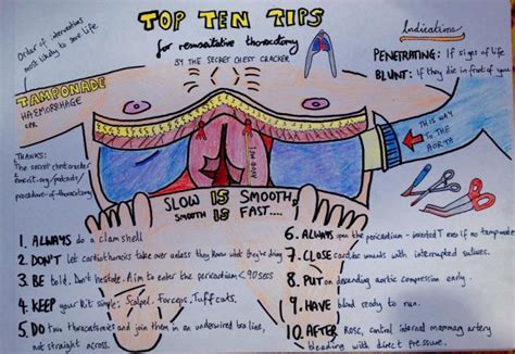 The Procedure of ED Thoracotomy