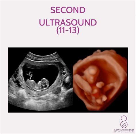 11 Week Ultrasound Gender Prediction and Its Accuracy