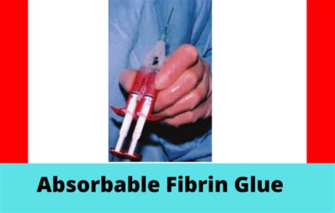 Global Absorbable Fibrin Glue Market Specifying Major Challenges and ...