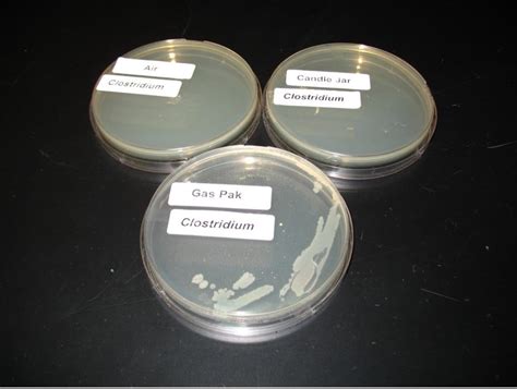 EFFECT OF OXYGEN ON BACTERIAL GROWTH – Red Mountain Microbiology