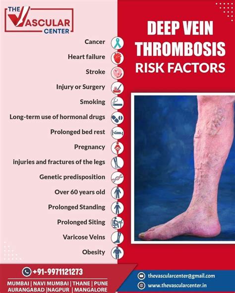 Deep Vein Thrombosis