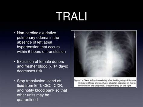 PPT - Chapter 24 - Blood Therapy PowerPoint Presentation, free download - ID:4801179