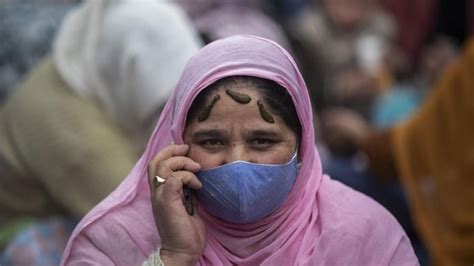 Picture of the day: A woman wearing a face mask undergoes leech therapy