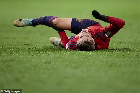 Barcelona star Gavi 'faces TEN MONTHS out' after surgery on ACL injury ...