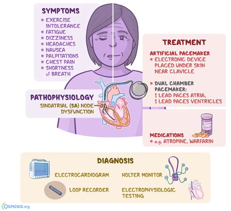 Sick Sinus Syndrome: What Is It, Symptoms, Causes, Diagnosis, Treatment, and More | Osmosis