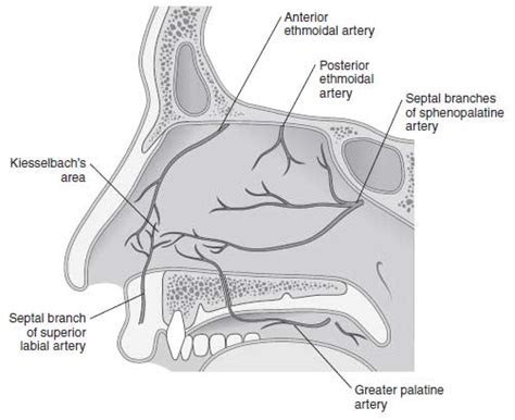 Epistaxis Case File