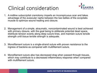 Principles of craniotomy flaps | PPT