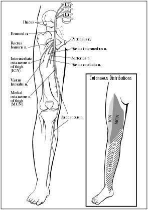 Femoral Nerve Pain: Causes & Treatment | Walk Without Pain