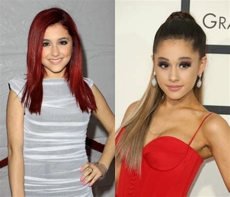 Ariana Grande Nose Job and Other Surgeries – Before and After Pictures ...