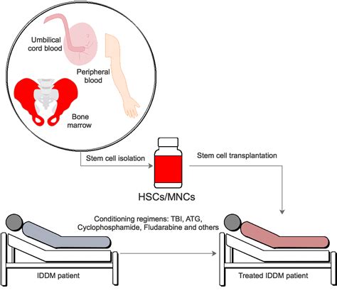 Hematopoietic Stem Cell Transplantation - Allogeneic Haematopoietic Stem Cell Transplantation ...