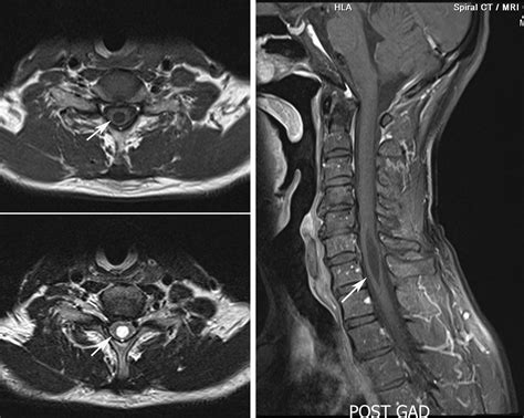 Radiodiagnosis - Imaging is Amazing-Interesting cases: January 2011