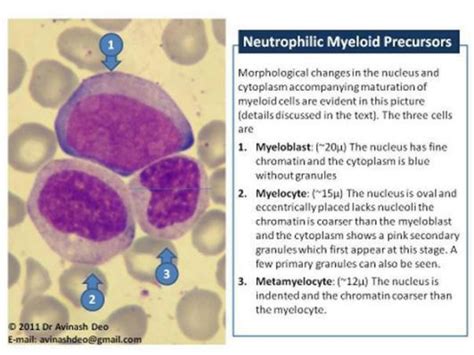 Morphology of Myeloid Precurssors | Hematology, Medical laboratory science, Medical technology