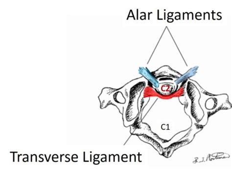 alar ligament treatment