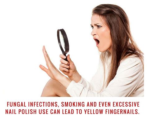 Yellow Fingernails: Causes and Treatments