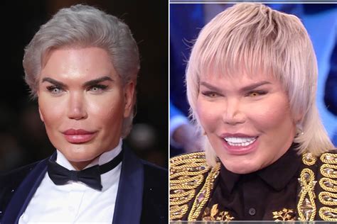 Ken Doll Rodrigo Alves Before Surgery, The Human Ken Doll Opens Up His ...