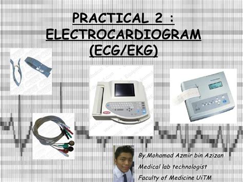 Parts Of Ecg Machine