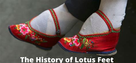 The History of “Lotus Feet” - The Checkup