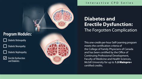 Diabetes and Erectile Dysfunction: The Forgotten Complication | HealthPlexus.net