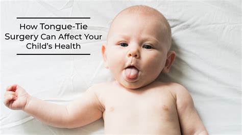 How Tongue-Tie Surgery Can Affect Your Child’s Health | LaptrinhX / News