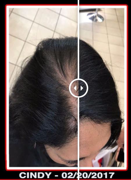 Hair Fibers Before and After Pictures - Instant Hair Fibers | Hair fibers, Hairstyles for thin ...