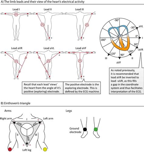 The ECG leads: electrodes, limb leads, chest (precordial) leads, 12 ...